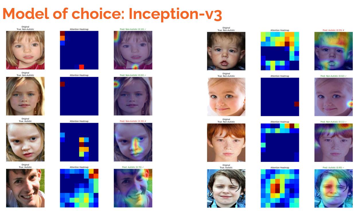 Autism Spectrum Disorder Detection